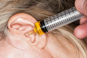 blocked ear wax removal